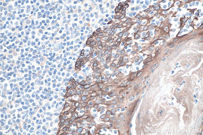 Cytokeratin 8 Antibody in Immunohistochemistry (Paraffin) (IHC (P))