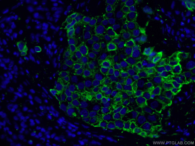 Cytokeratin 8 Antibody in Immunohistochemistry (PFA fixed) (IHC (PFA))