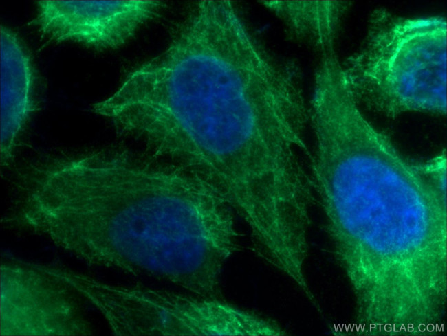 Cytokeratin 8 Antibody in Immunocytochemistry (ICC/IF)