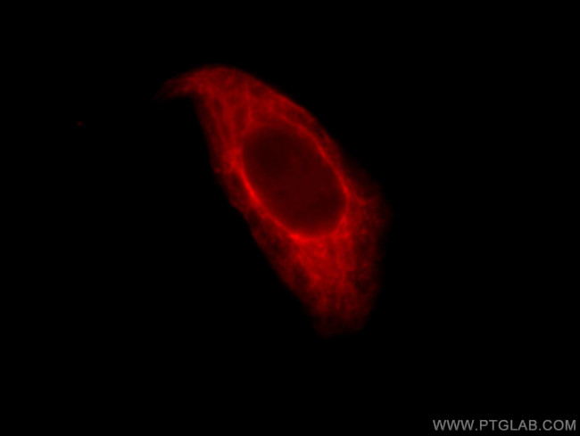 Cytokeratin 8 Antibody in Immunocytochemistry (ICC/IF)