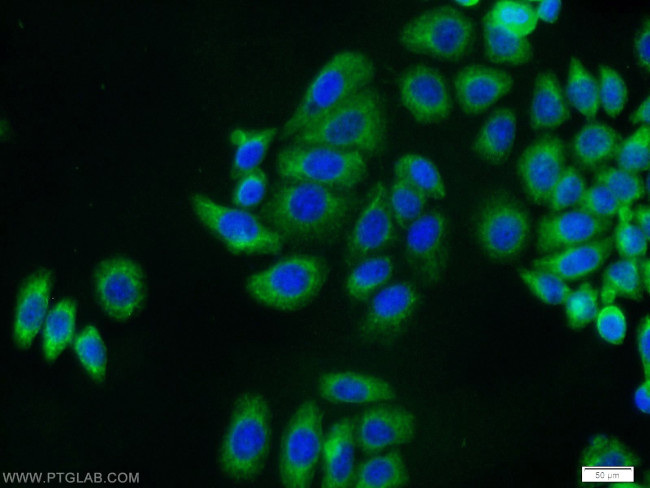 Cytokeratin 8 Antibody in Immunocytochemistry (ICC/IF)