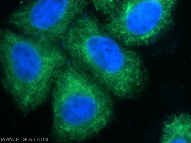 Cytokeratin 8 Antibody in Immunocytochemistry (ICC/IF)