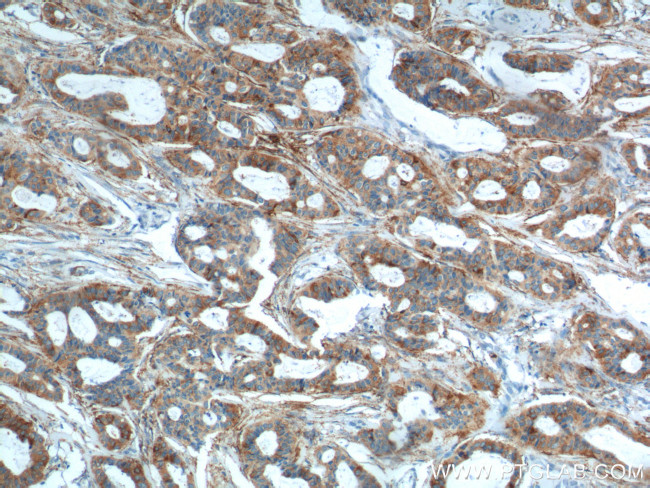 Cytokeratin 8 Antibody in Immunohistochemistry (Paraffin) (IHC (P))