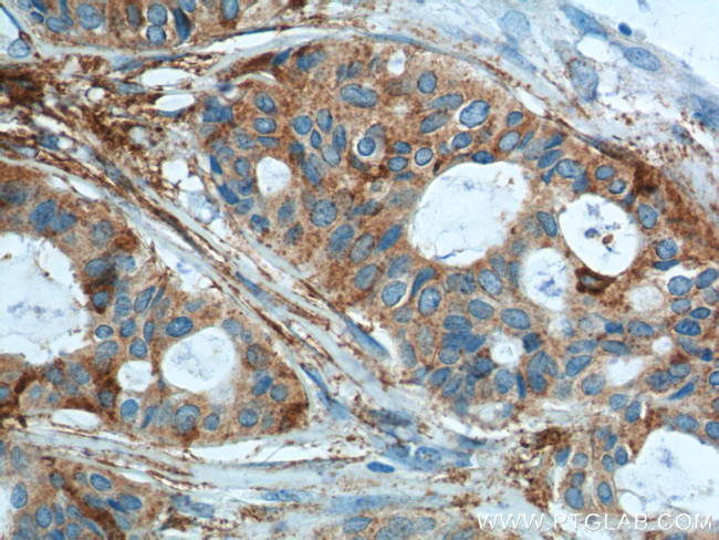 Cytokeratin 8 Antibody in Immunohistochemistry (Paraffin) (IHC (P))