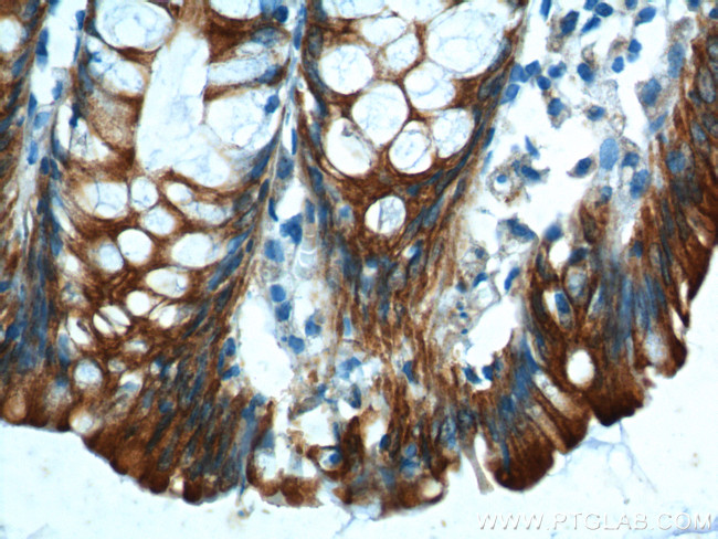 Cytokeratin 8 Antibody in Immunohistochemistry (Paraffin) (IHC (P))