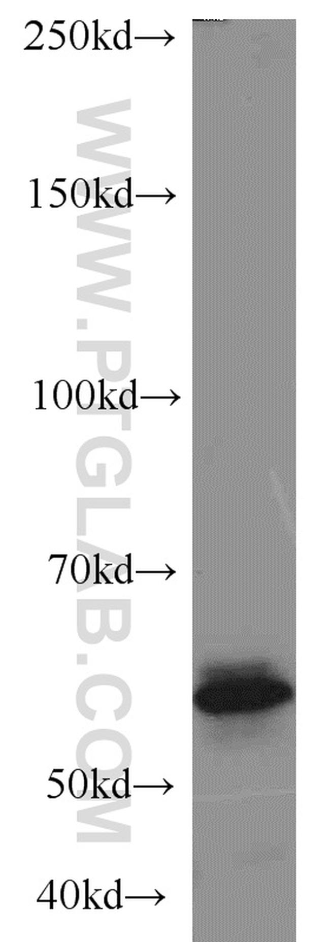 Cytokeratin 8 Antibody in Western Blot (WB)