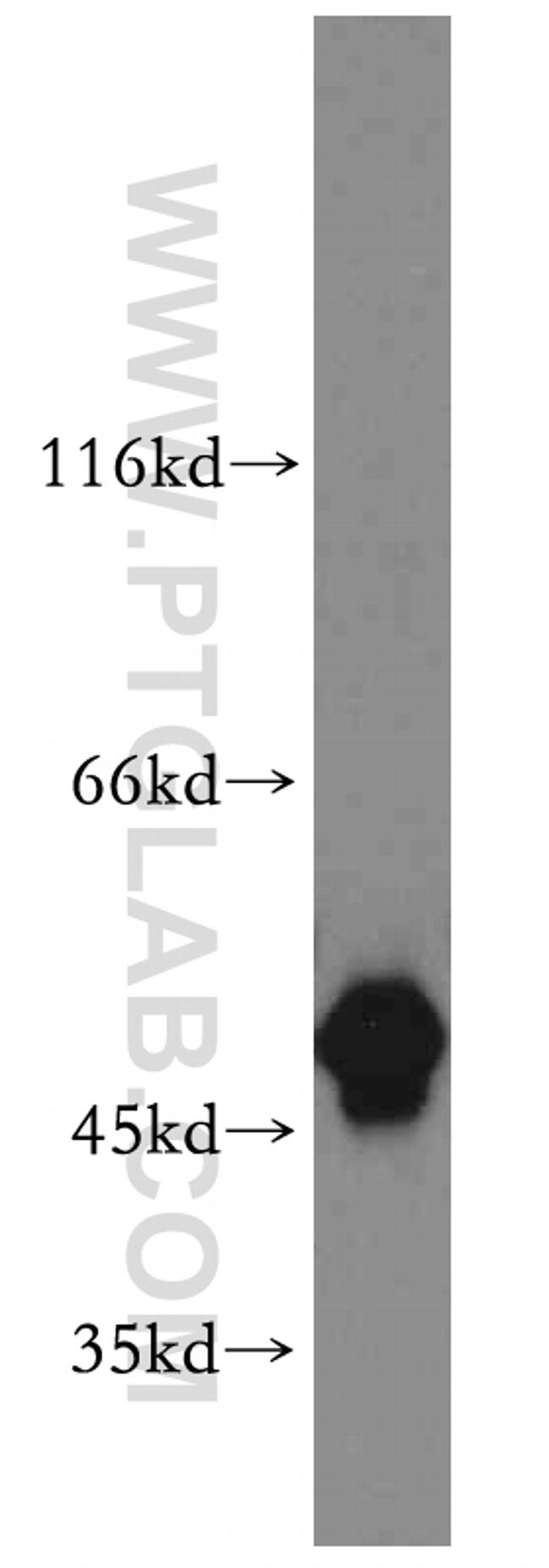 Cytokeratin 8 Antibody in Western Blot (WB)