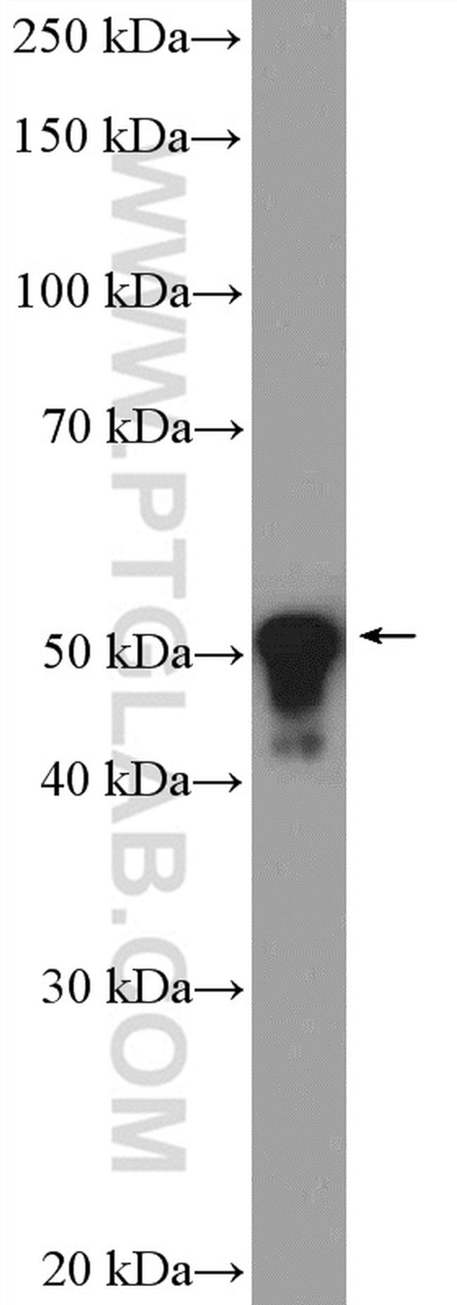 Cytokeratin 8 Antibody in Western Blot (WB)