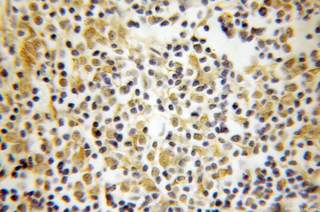 OCT1 Antibody in Immunohistochemistry (Paraffin) (IHC (P))