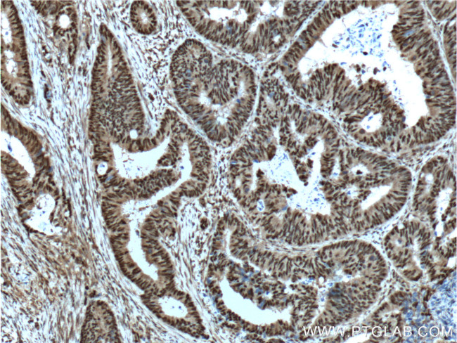 OCT1 Antibody in Immunohistochemistry (Paraffin) (IHC (P))