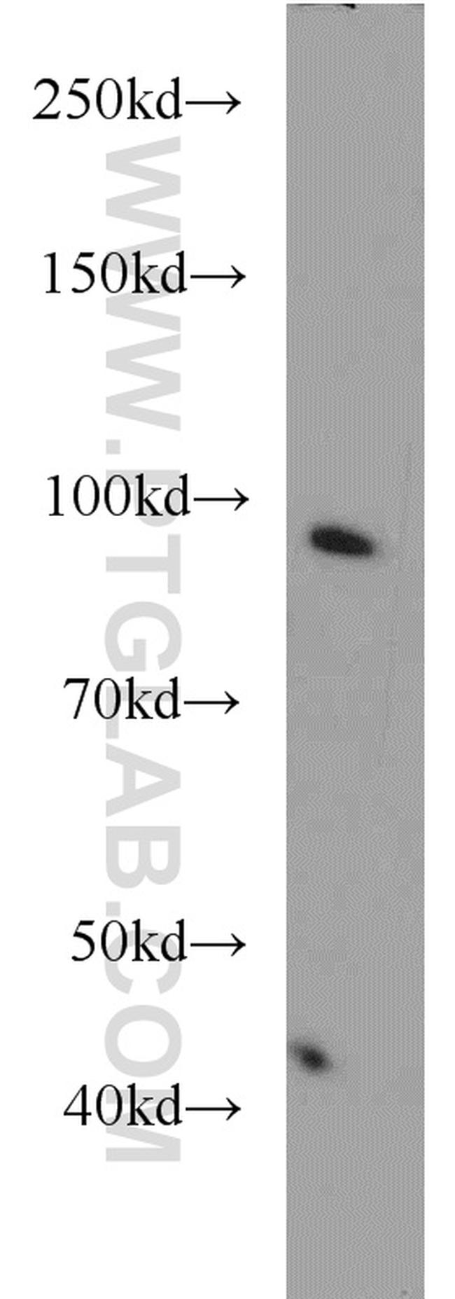 OCT1 Antibody in Western Blot (WB)