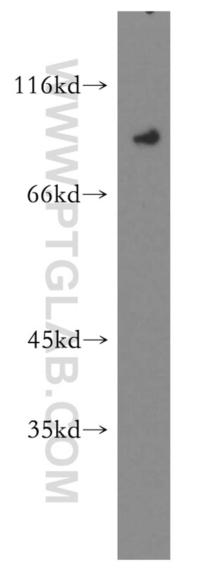 OCT1 Antibody in Western Blot (WB)