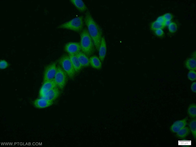 HGS Antibody in Immunocytochemistry (ICC/IF)