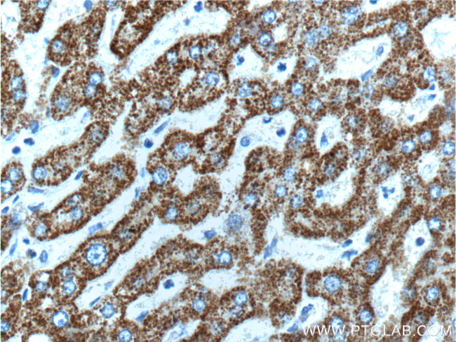 HGS Antibody in Immunohistochemistry (Paraffin) (IHC (P))