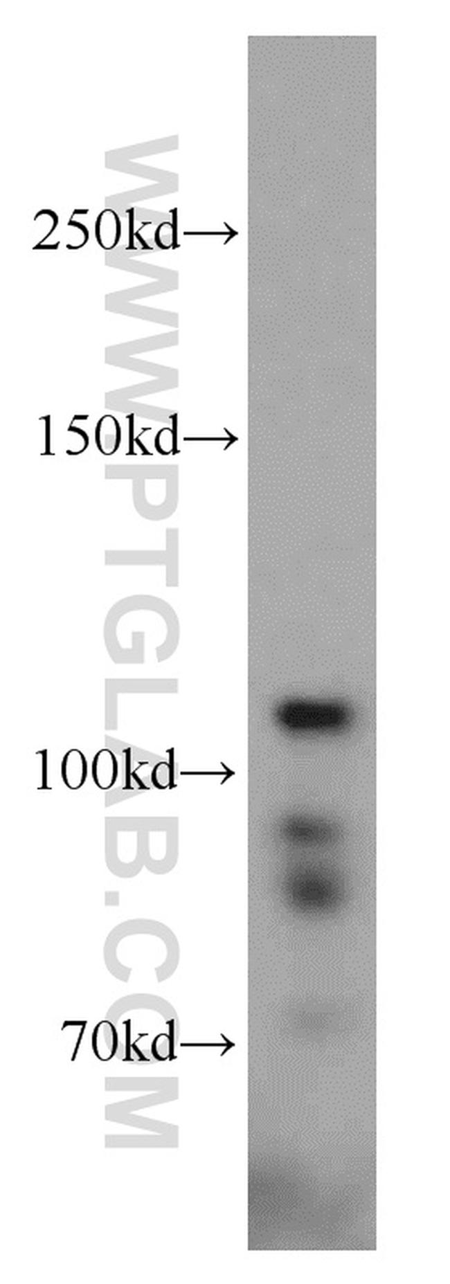 HGS Antibody in Western Blot (WB)