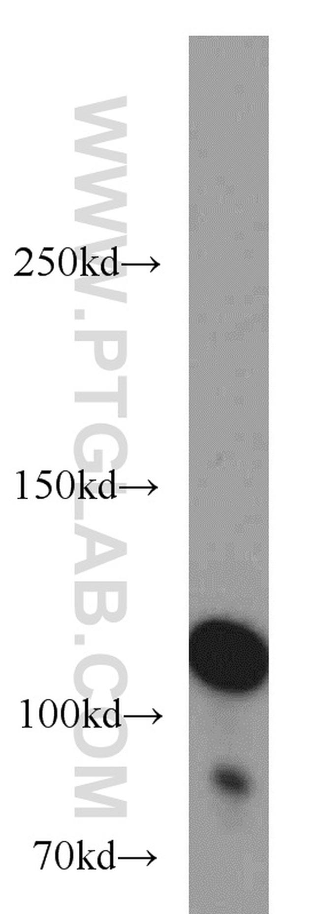 HGS Antibody in Western Blot (WB)