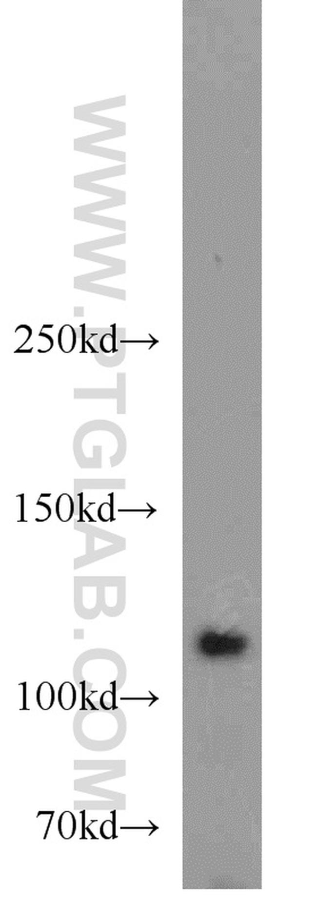 HGS Antibody in Western Blot (WB)