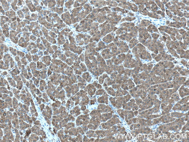 UGP2 Antibody in Immunohistochemistry (Paraffin) (IHC (P))