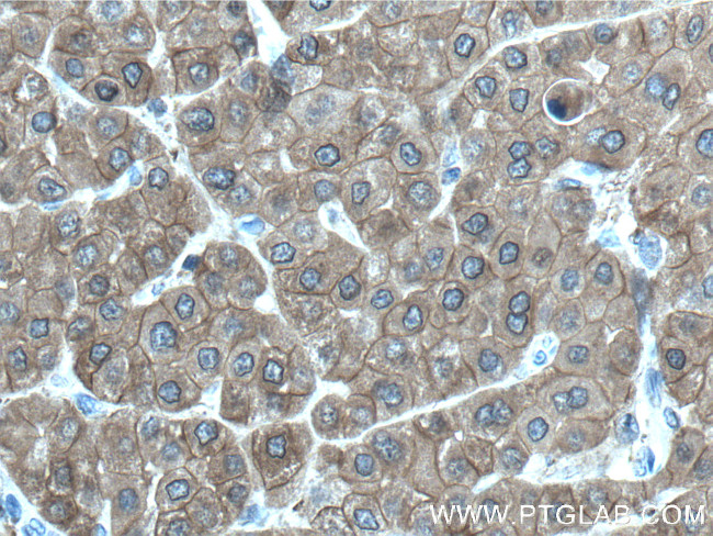 UGP2 Antibody in Immunohistochemistry (Paraffin) (IHC (P))