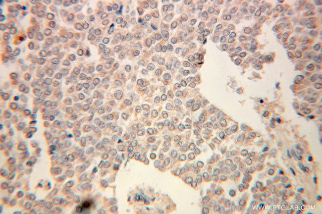 UGP2 Antibody in Immunohistochemistry (Paraffin) (IHC (P))