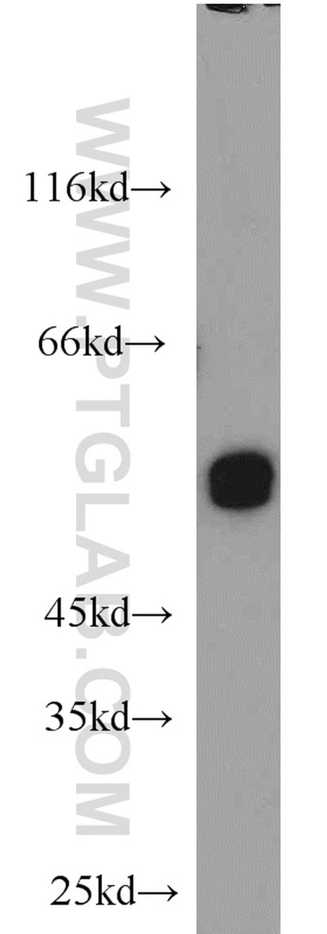 UGP2 Antibody in Western Blot (WB)