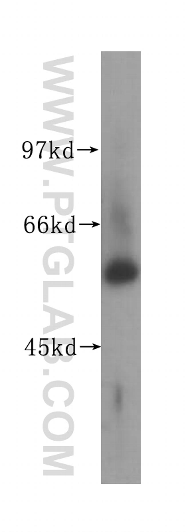 UGP2 Antibody in Western Blot (WB)