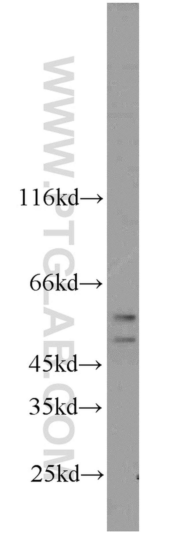 CFLAR/FLIP Antibody in Western Blot (WB)