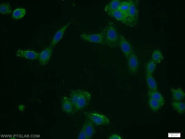 CFLAR/FLIP Antibody in Immunocytochemistry (ICC/IF)