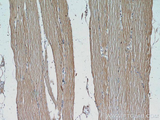 CFLAR/FLIP Antibody in Immunohistochemistry (Paraffin) (IHC (P))