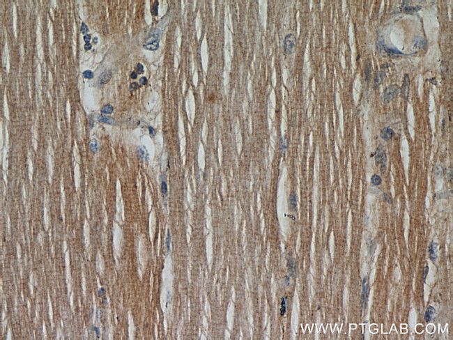 CFLAR/FLIP Antibody in Immunohistochemistry (Paraffin) (IHC (P))