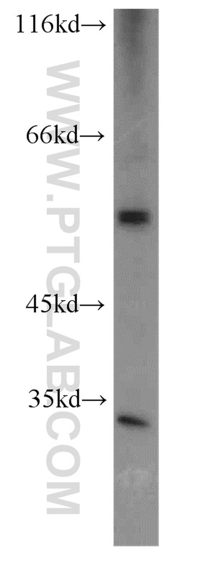 CFLAR/FLIP Antibody in Western Blot (WB)