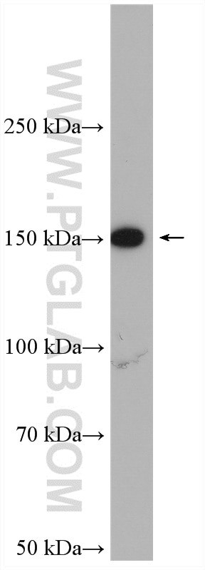 FMNL1 Antibody in Western Blot (WB)