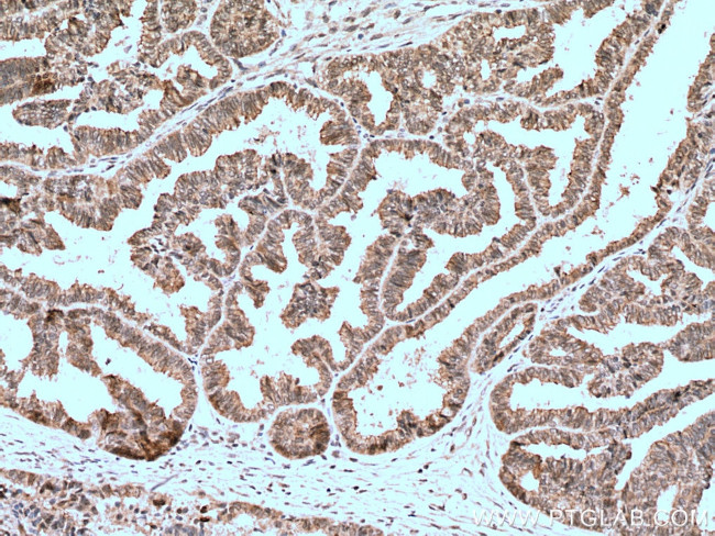 BAP1 Antibody in Immunohistochemistry (Paraffin) (IHC (P))