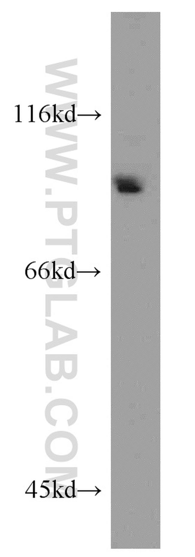 BAP1 Antibody in Western Blot (WB)