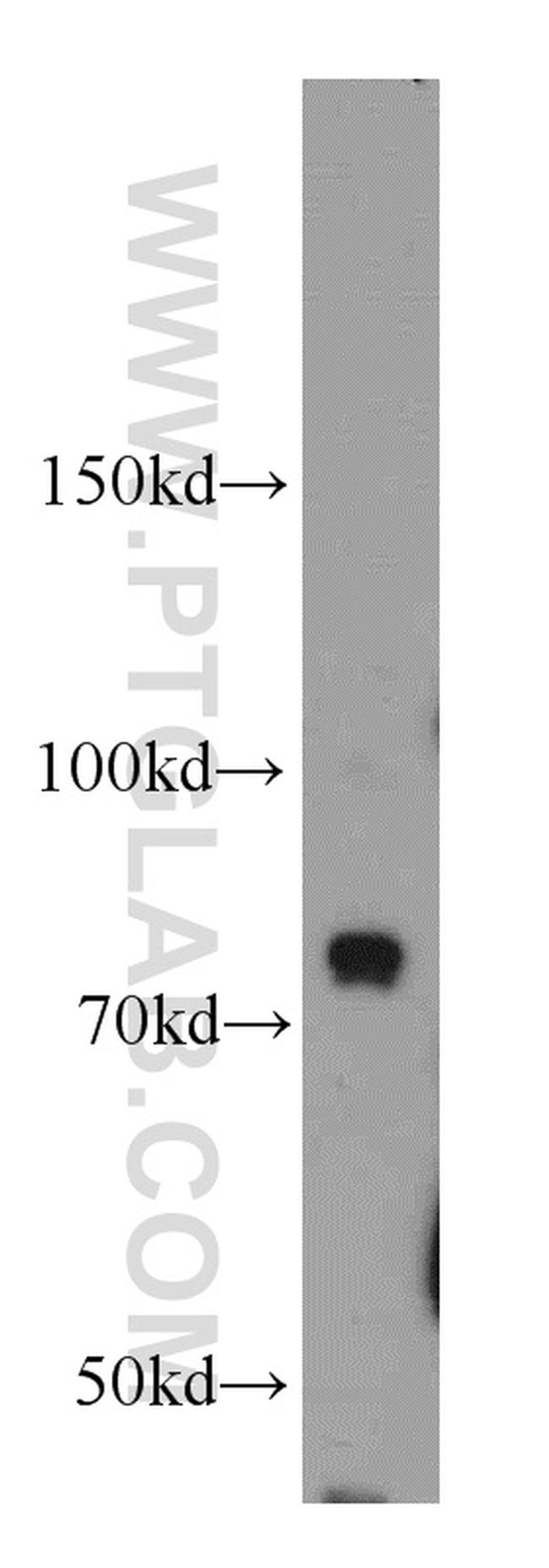 BCAS3 Antibody in Western Blot (WB)