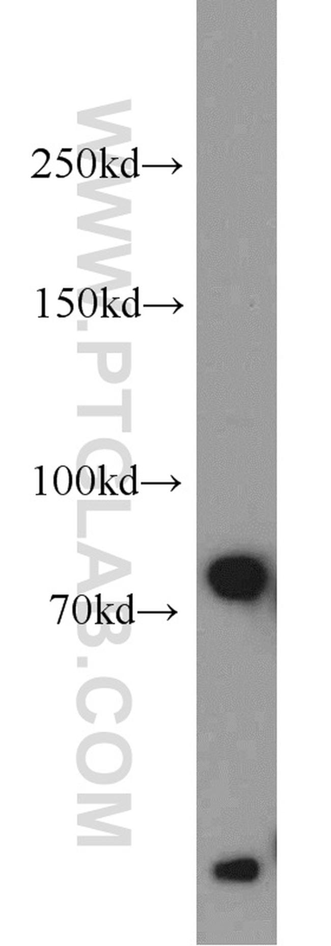 BCAS3 Antibody in Western Blot (WB)