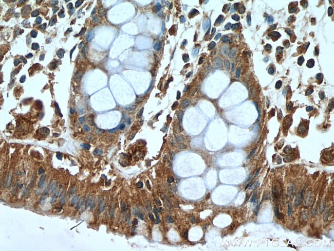 Cytohesin 2 Antibody in Immunohistochemistry (Paraffin) (IHC (P))