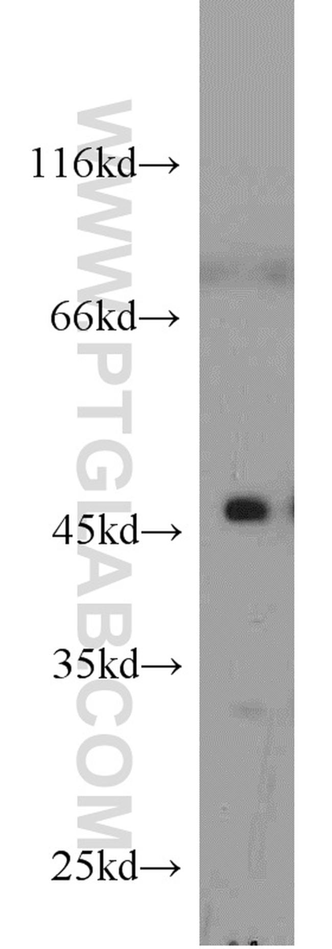 Cytohesin 2 Antibody in Western Blot (WB)