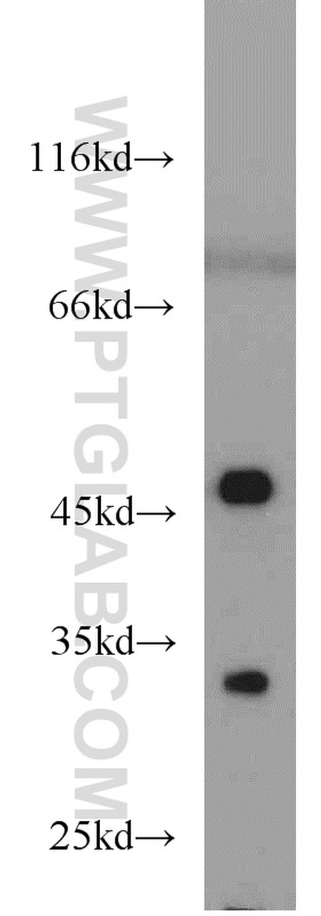 Cytohesin 2 Antibody in Western Blot (WB)