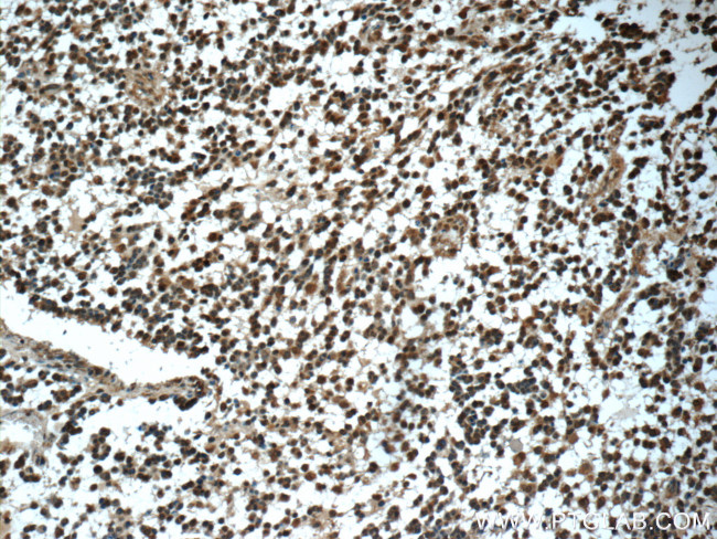 Syntenin 2 Antibody in Immunohistochemistry (Paraffin) (IHC (P))