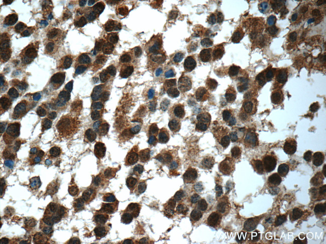 Syntenin 2 Antibody in Immunohistochemistry (Paraffin) (IHC (P))