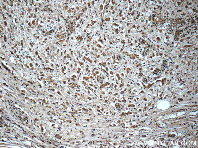 Syntenin 2 Antibody in Immunohistochemistry (Paraffin) (IHC (P))