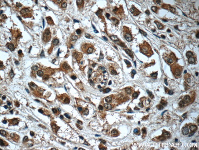 Syntenin 2 Antibody in Immunohistochemistry (Paraffin) (IHC (P))