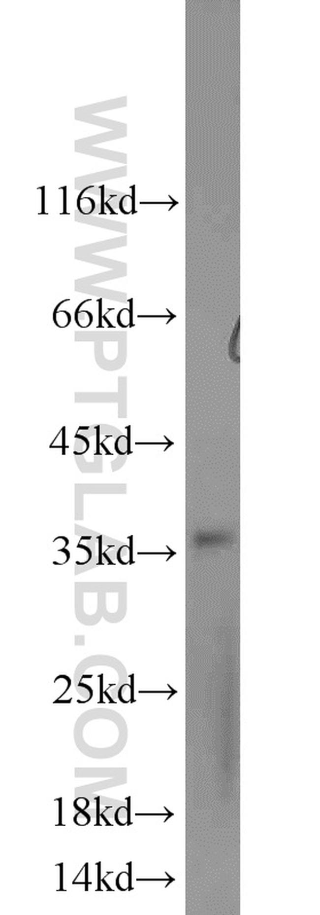 Syntenin 2 Antibody in Western Blot (WB)