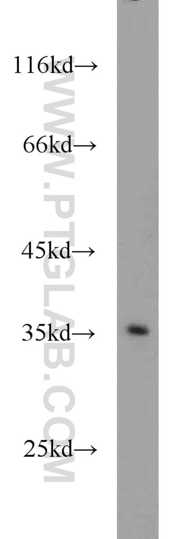 Syntenin 2 Antibody in Western Blot (WB)