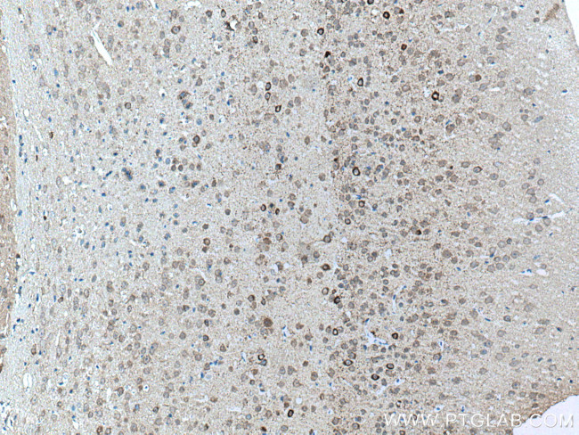 GAD1 Antibody in Immunohistochemistry (Paraffin) (IHC (P))