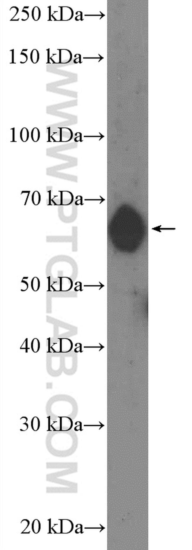 GAD1 Antibody in Western Blot (WB)