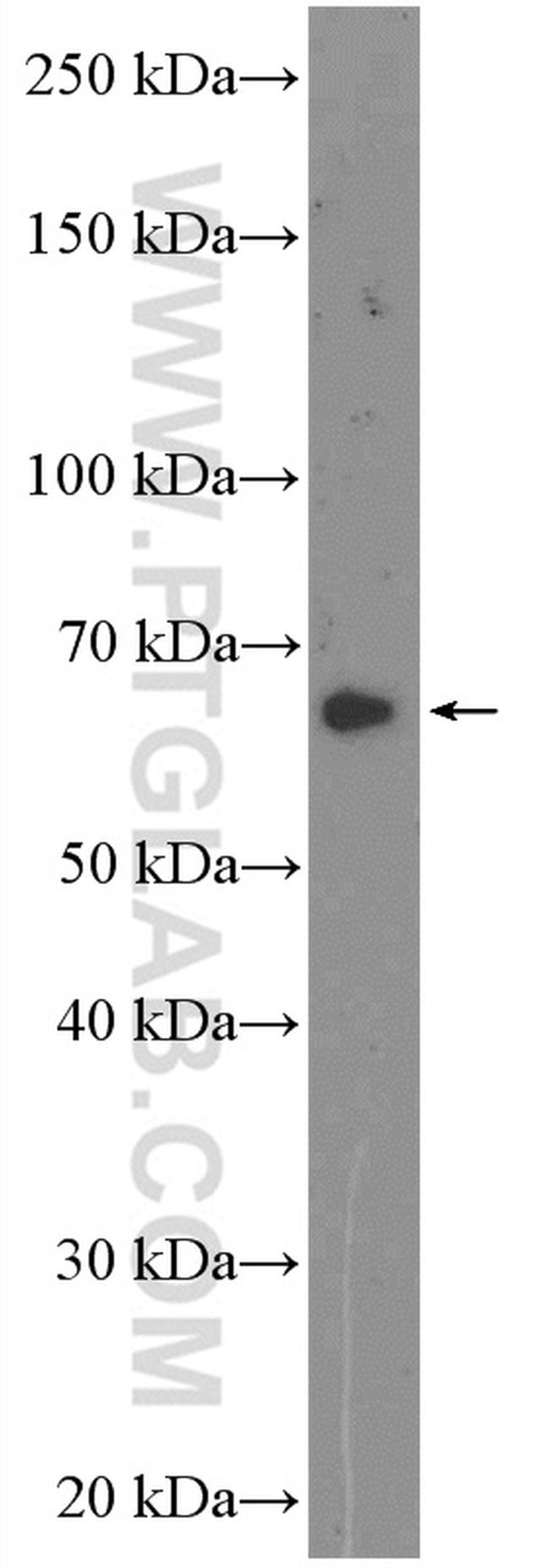 GAD1 Antibody in Western Blot (WB)