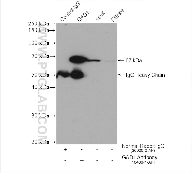 GAD1 Antibody in Immunoprecipitation (IP)