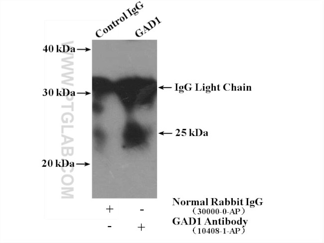 GAD1 Antibody in Immunoprecipitation (IP)